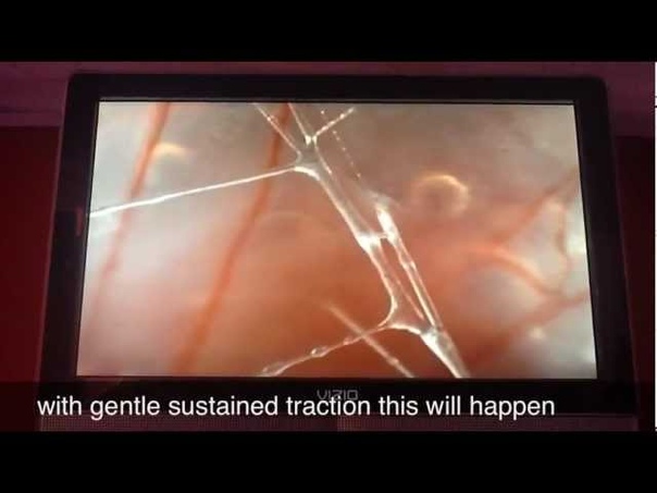 Fascia Magnified 25x (