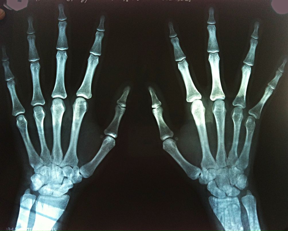 Анна Андреева | Москва