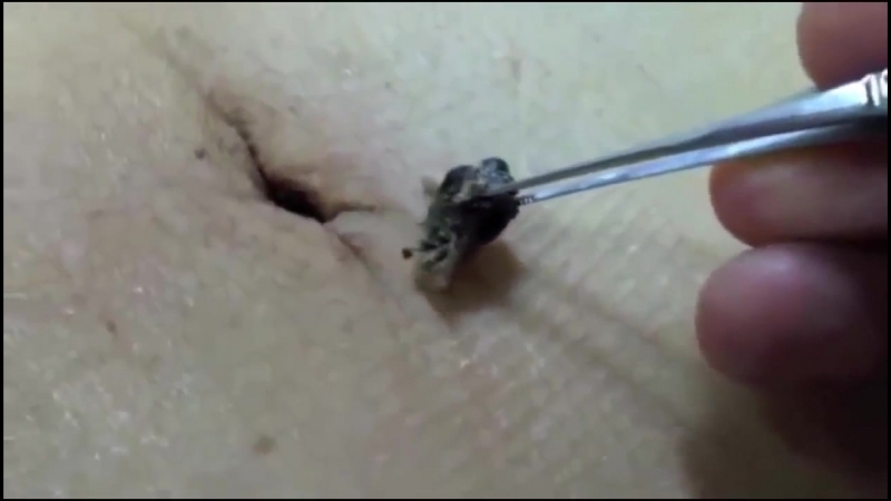 Удаление огромной черной