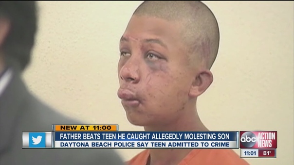 Father beats teen he caught allegedly molesting